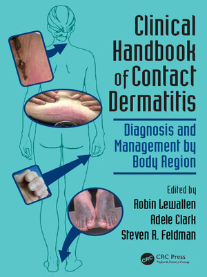 cover image of Clinical Handbook of Contact Dermatitis